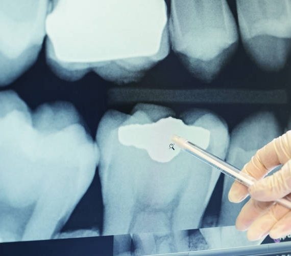 οδοντιατρική ακτινογραφία
