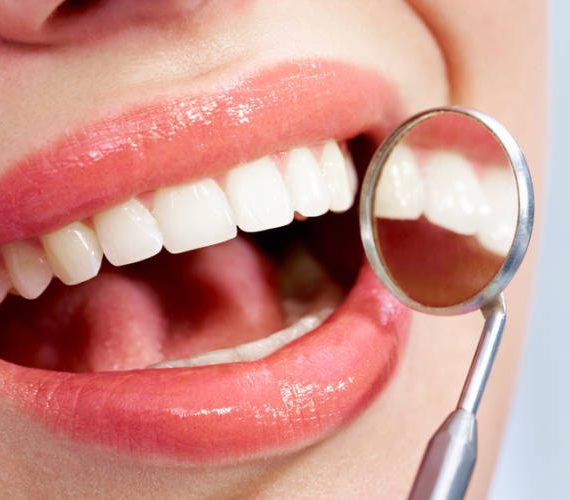Λευκά δόντια - www.dentalalert.gr