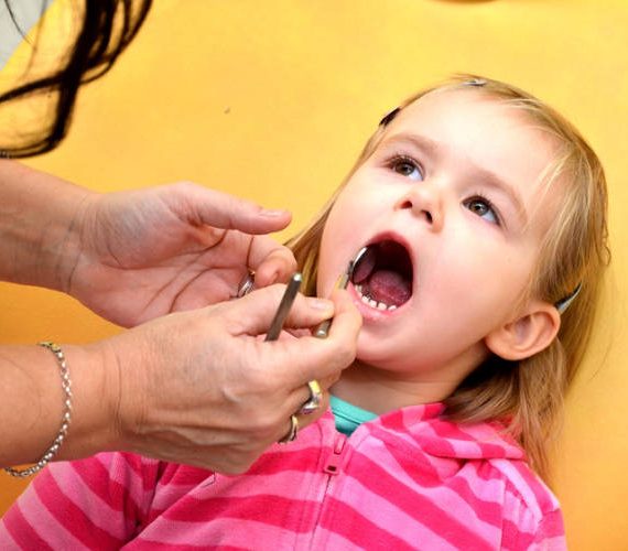 Η κατάλληλη εποχή για τον προληπτικό έλεγχο των δοντιών του παιδιού