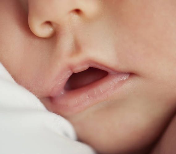 Τι κακό μπορεί να κάνει η μόνιμη αναπνοή από το στόμα σε ενήλικες και παιδιά;