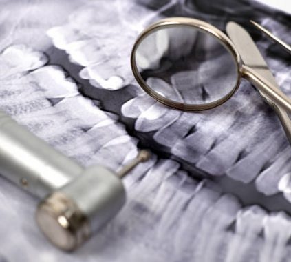 5 βασικοί λόγοι που ο οδοντίατρος χρειάζονται την πανοραμική ακτινογραφία