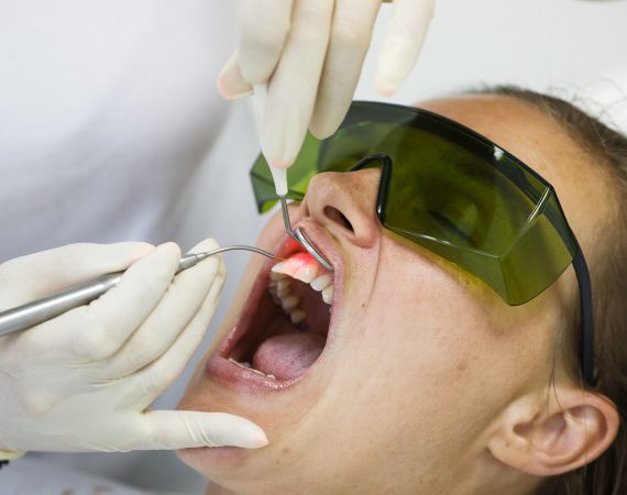 laser -www.dentalalert.gr