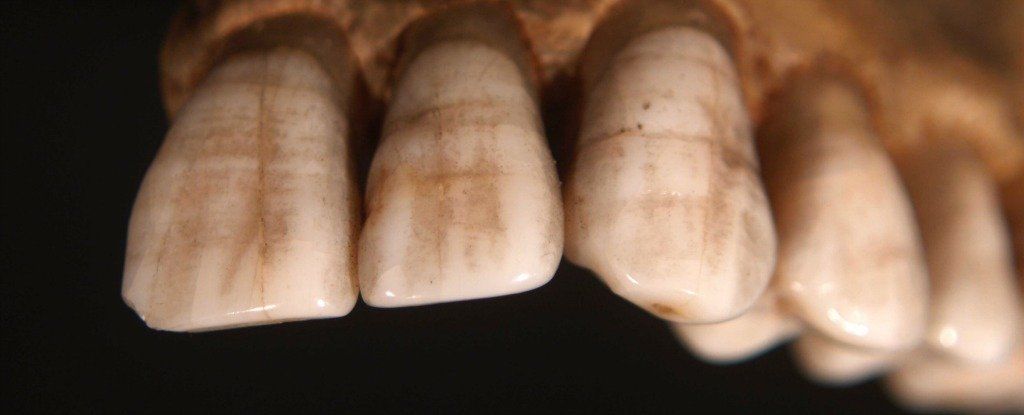 Παλαιολιθική Διατροφή: Τι αποκαλύπτουν τα προϊστορικά δόντια