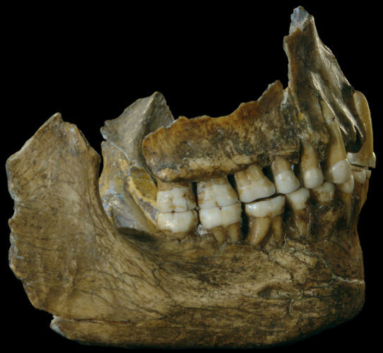 Προϊστορική Ασπιρίνη βρέθηκε στα δόντια Νεάντερταλ!