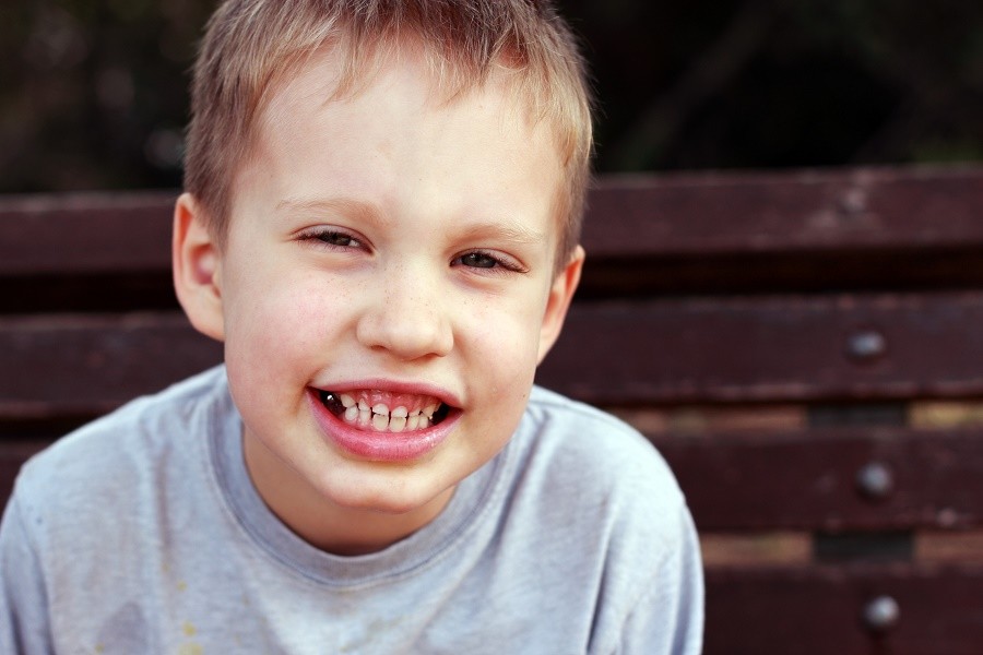 Είναι τα πρώτα δόντια δείκτες για τον αυτισμό;