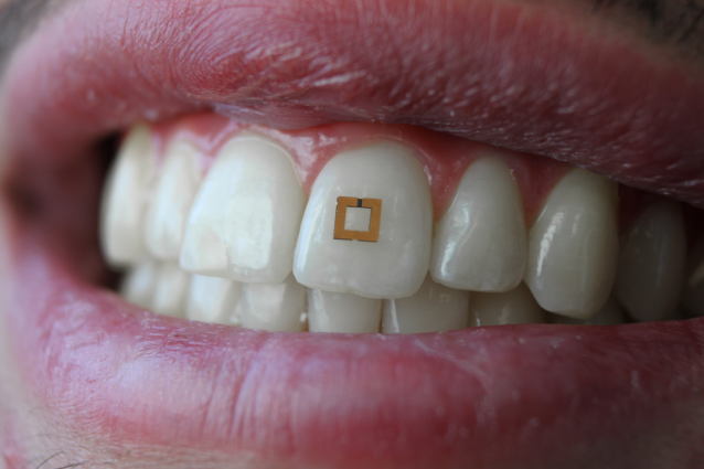 Επιστήμονες αναπτύσσουν μικροσκοπικούς αισθητήρες για τα δόντια που εντοπίζουν ό,τι τρώμε!