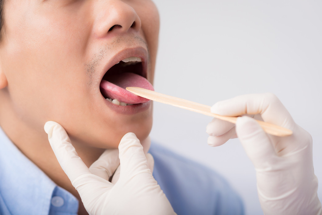 2,5% αύξηση παρουσιάζουν οι καρκίνοι του στόματος και κεφαλής που συνδέονται με HPV λοίμωξη!