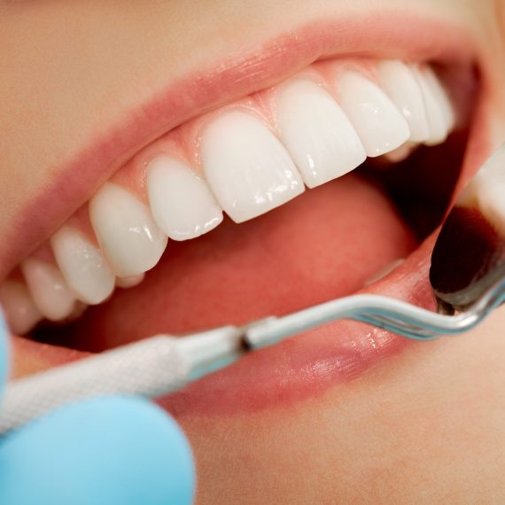 Πως μπορούμε να κάνουμε καλύτερη και ανθεκτικότερη σύνθετη αποκατάσταση δοντιών